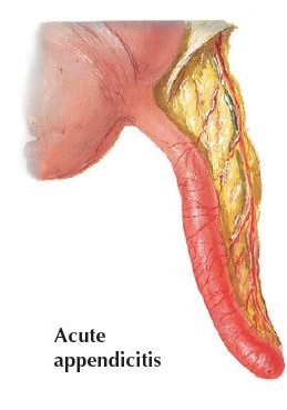  positions of appendix